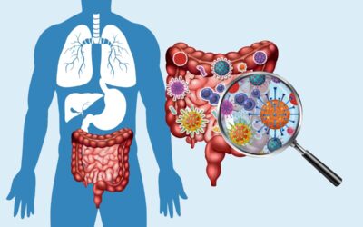 SIBO : pourquoi les probiotiques aggravent parfois les symptômes